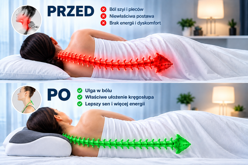 Ovelo NeckRelief — Ortopedyczna Poduszka Motylkowa na Ból Szyi i Karku